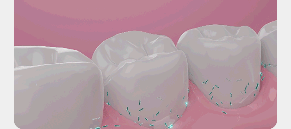 01_b.gif