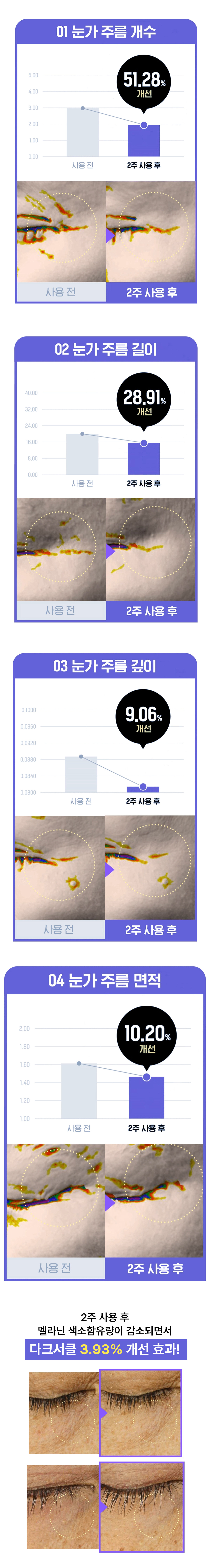 %ED%97%88%EB%B8%94%EB%A3%B8%20%EC%95%84%EC%9D%B4%ED%81%AC%EB%A6%BC%20%EC%83%81%EC%84%B8%ED%8E%98%EC%9D%B4%EC%A7%8002.jpg