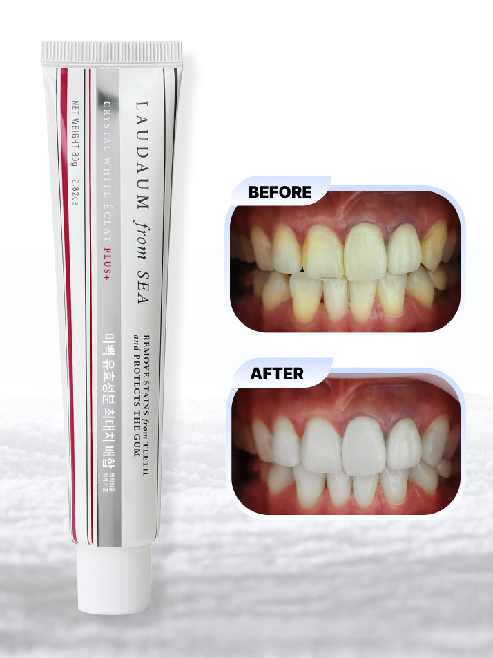 [치약형 강력 미백제] 닦아쓰는 특허 미백제