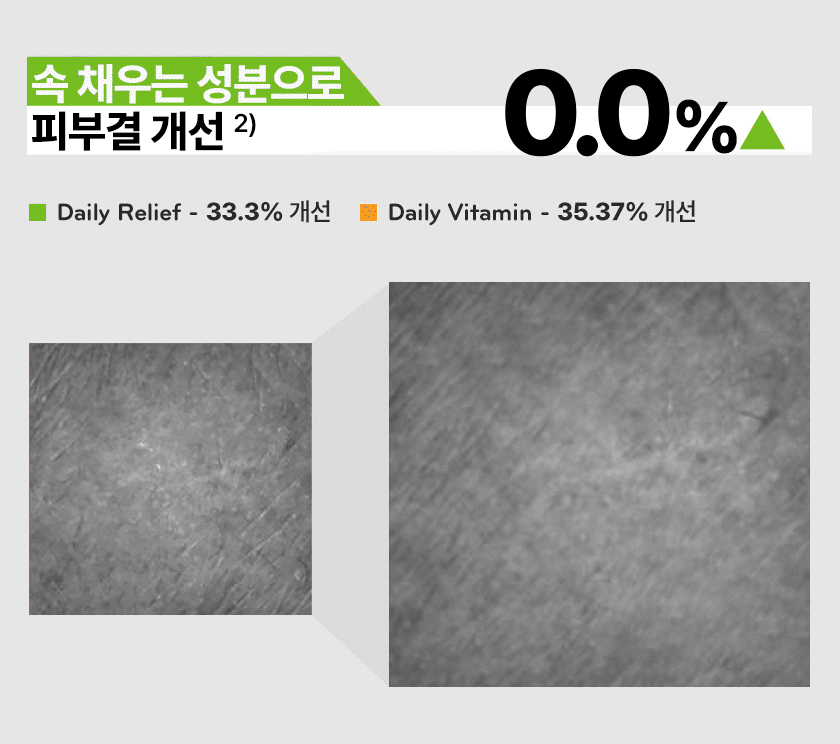NEW_%EC%97%A0%EB%9D%BD%ED%8B%B4_%EC%83%81%EC%84%B8%ED%8E%98%EC%9D%B4%EC%A7%80_10.gif