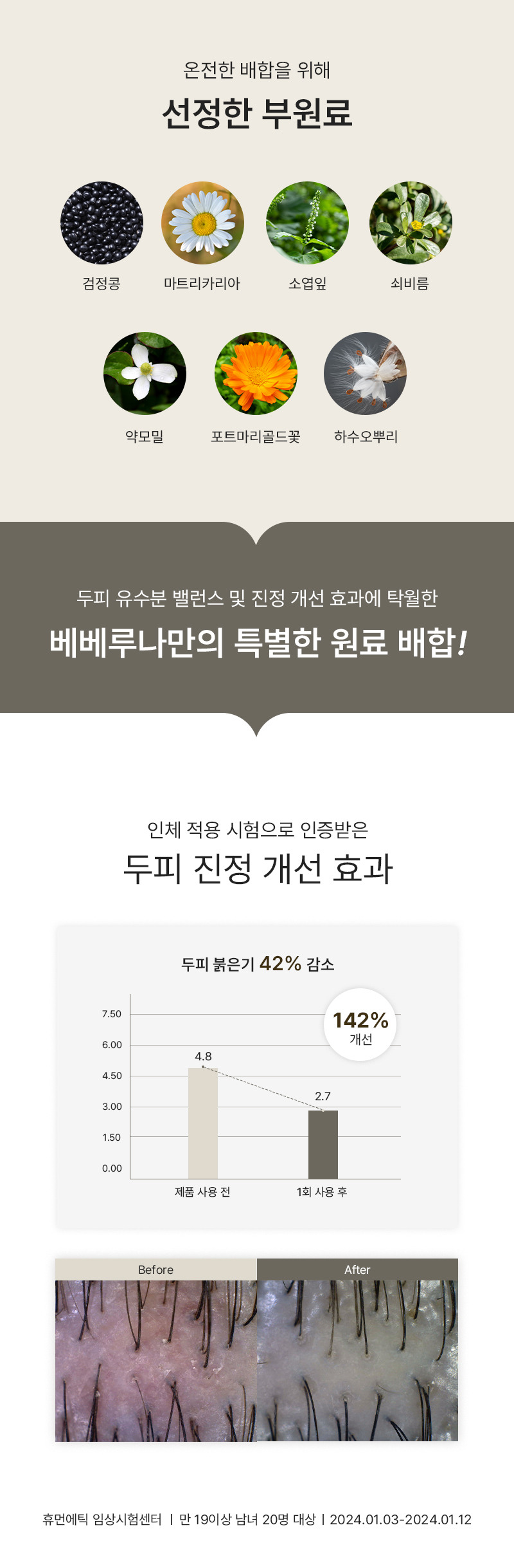 240408_%EB%A3%A8%EB%82%98%EC%97%90%EC%9D%B4%EC%B9%98%EB%B0%B8%EB%9F%B0%EC%8B%B1_%EC%83%81%EC%84%B8%ED%8E%98%EC%9D%B4%EC%A7%802.jpg